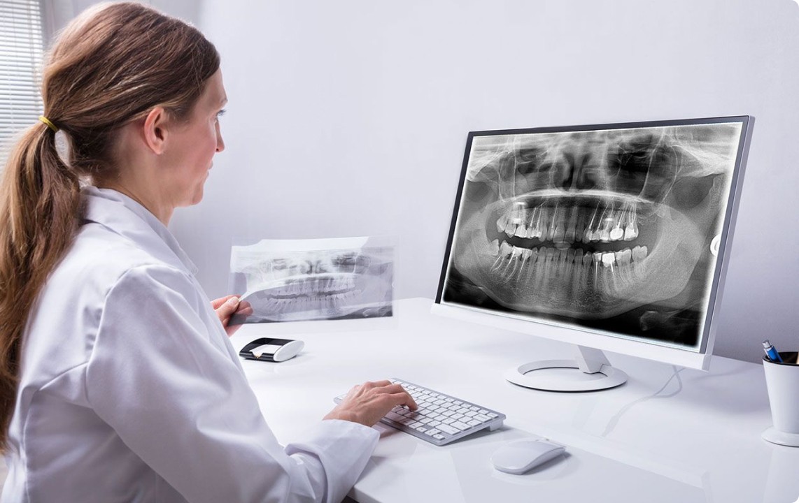 Implants dentaires au cabinet dentaire des Drs Metz & Zettel
